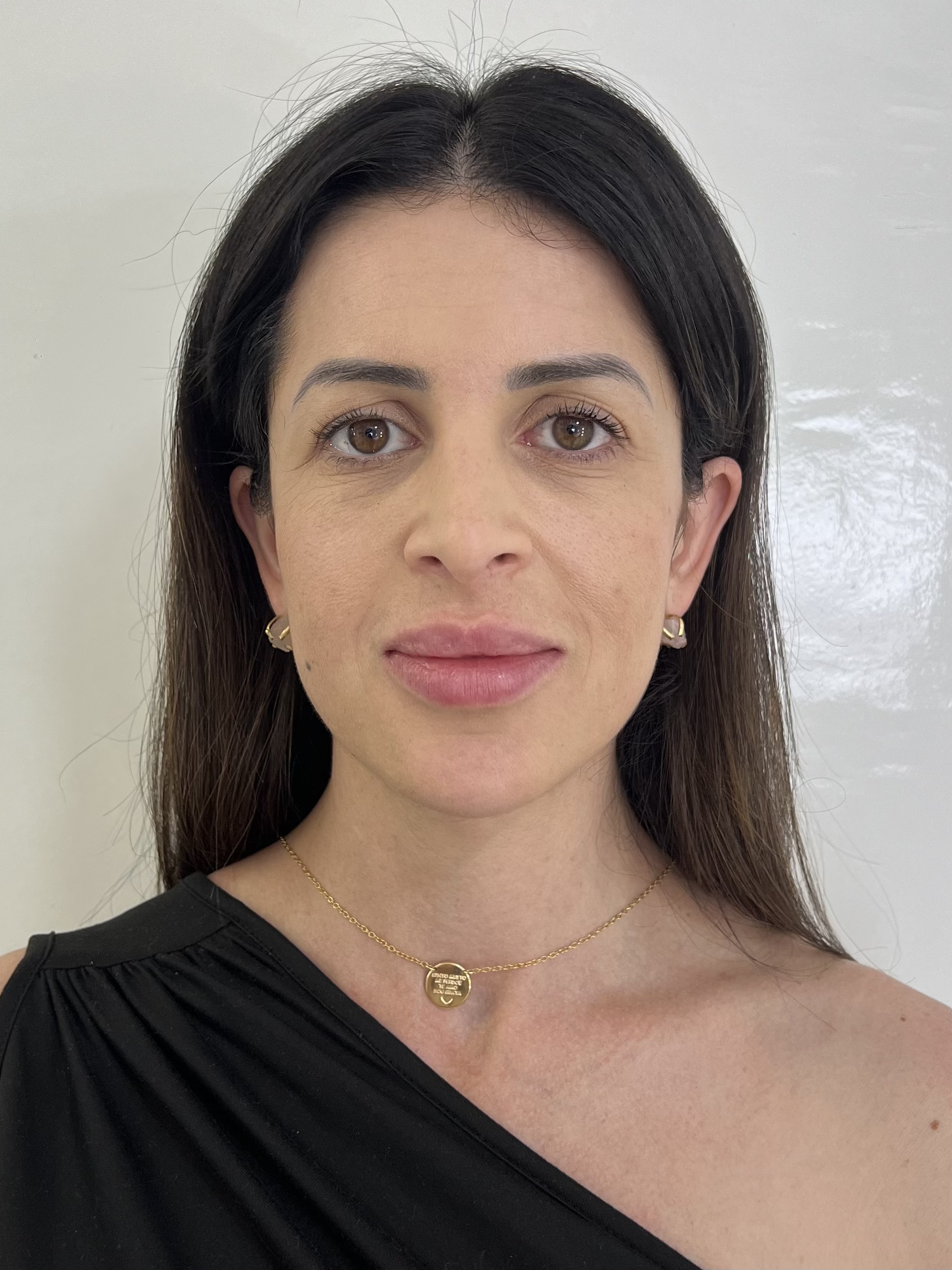 Rita antes do tratamento - frente